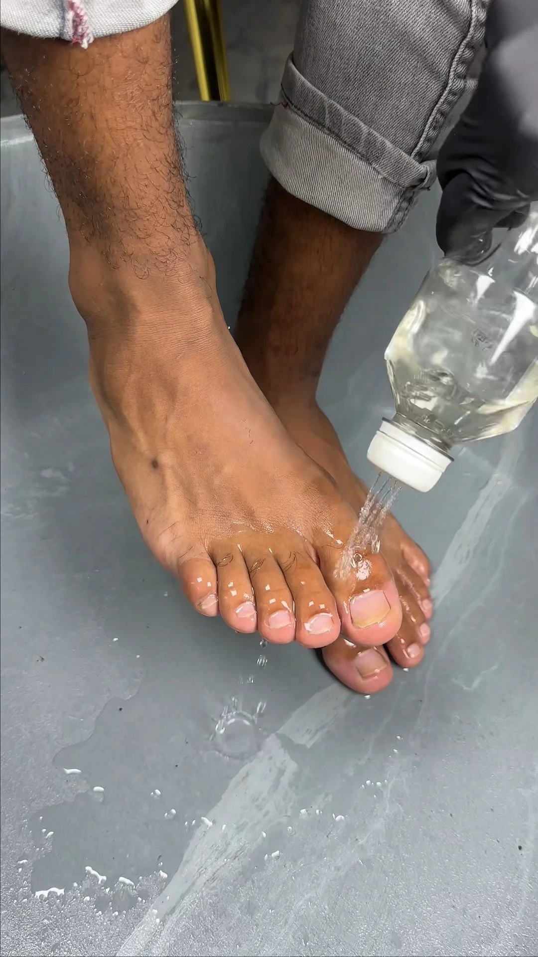 Vinegar treatment for yellow and dry nails affected by nail fungus.
